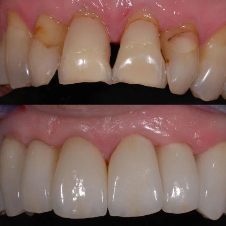 carilles-ceramica