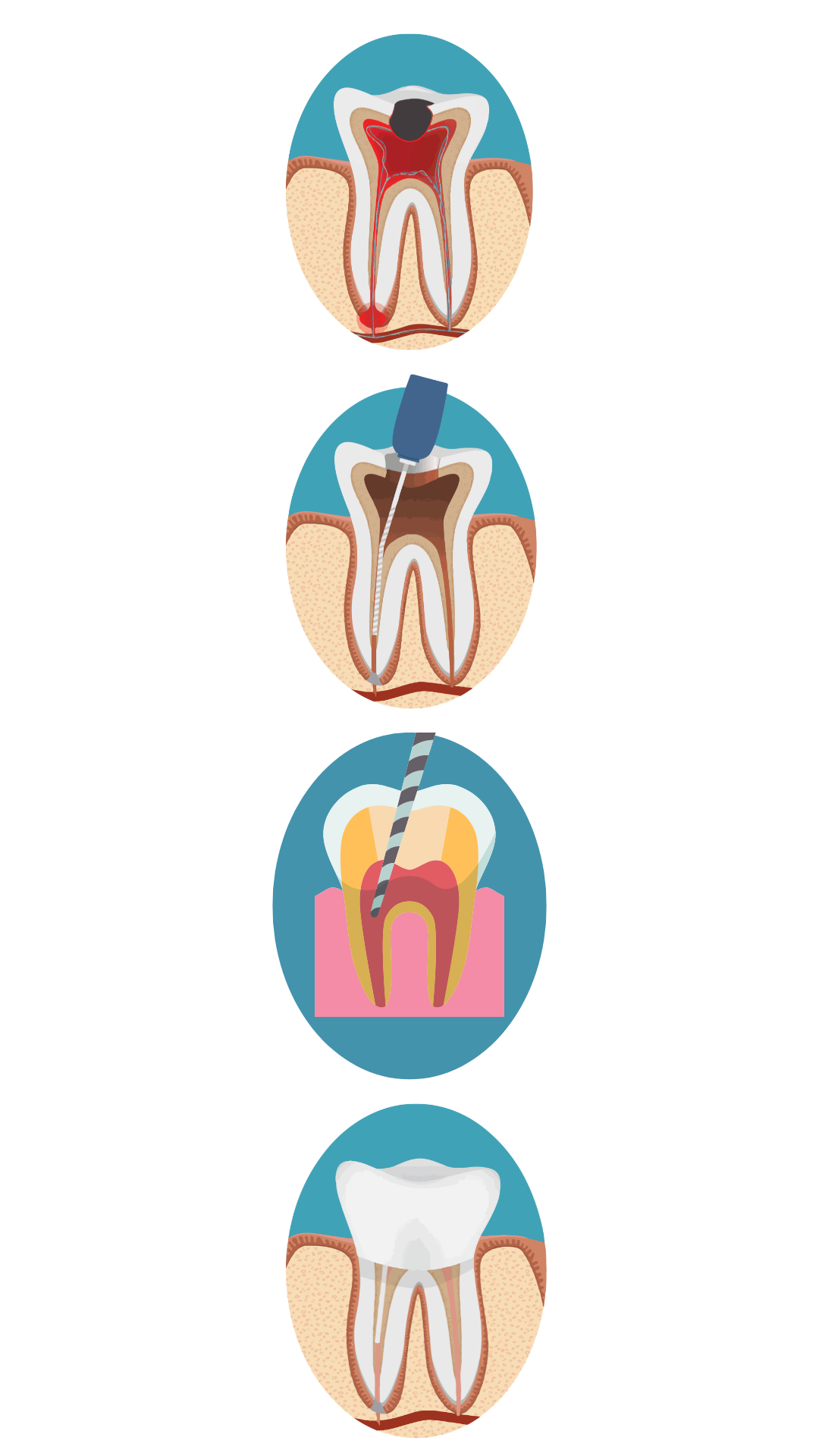 endodoncia 2