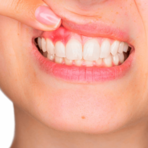 periodoncia