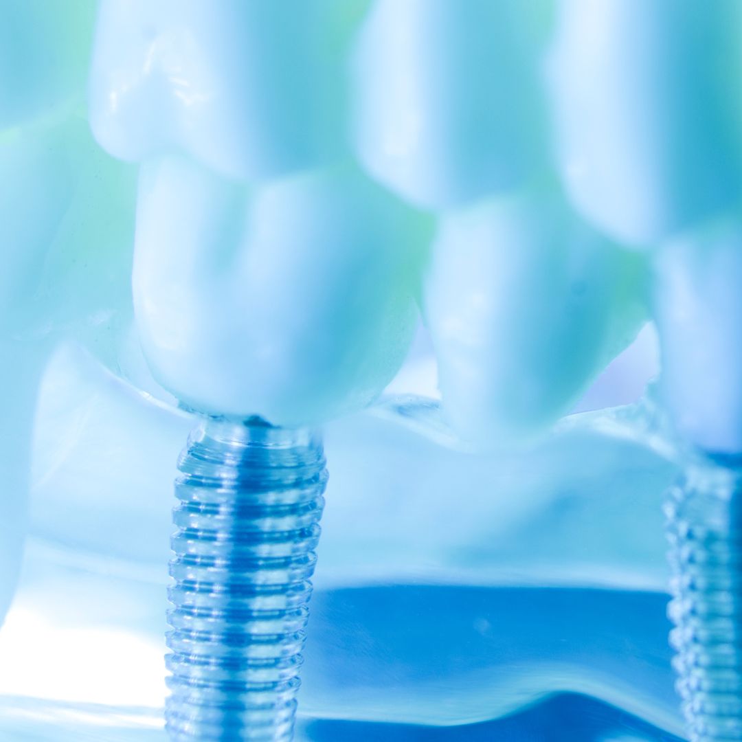estetica dental (1)