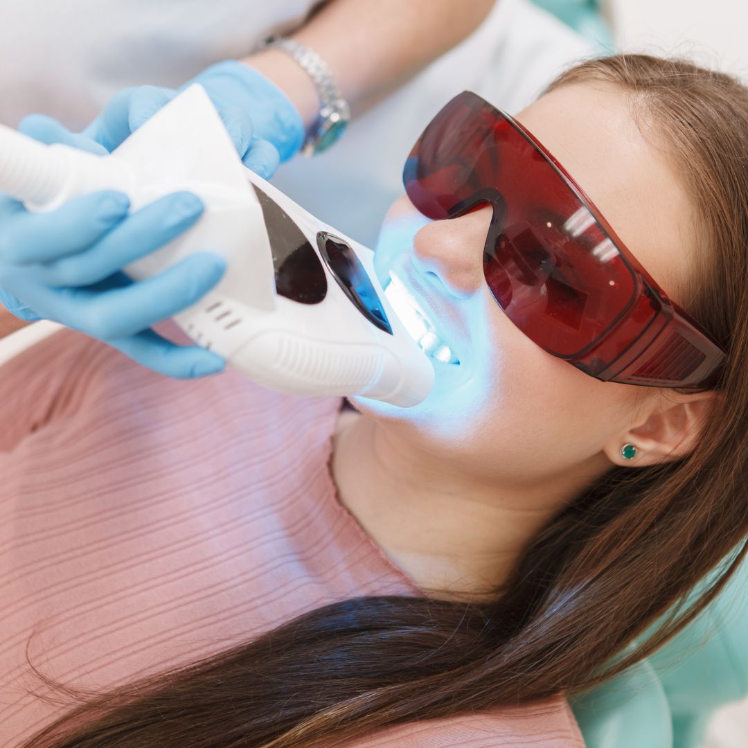 estetica dental